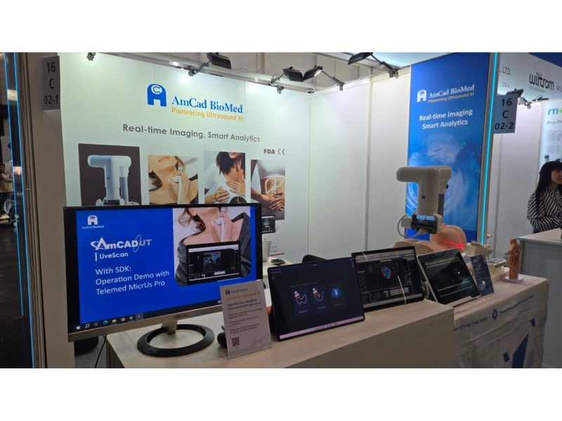 安克生醫的AI掌超和睡眠呼吸中止症檢測系統，在MEDICA獲得亮眼表現。