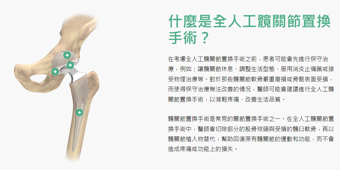 圖 片 截 取 自 聯 合 骨 科 官 網 