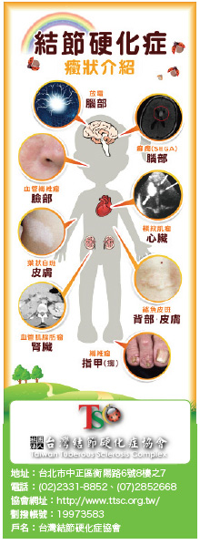結節．瓢蟲．TTSC