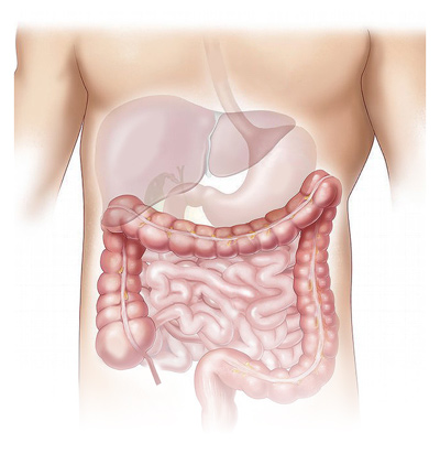 外表看來是瘦子 竟有胖子的「脂肪肝」